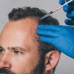 Bio FUE and FUT Hair Transplant